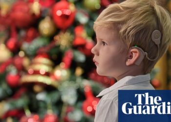 Cochlear Implants Complement Sign Language in Managing Deafness and Hearing Loss